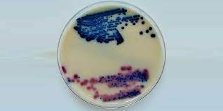 محیط کشت میلک اگار چیست