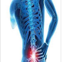 فعالیت های مضر برای دیسک کمر