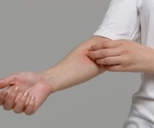 دلیل اصلی تمام خارش های بدن