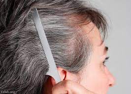 دلایل سفیدشدن زود هنگام موها در جوانان