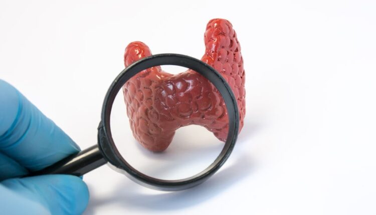 سرطان تیروئید