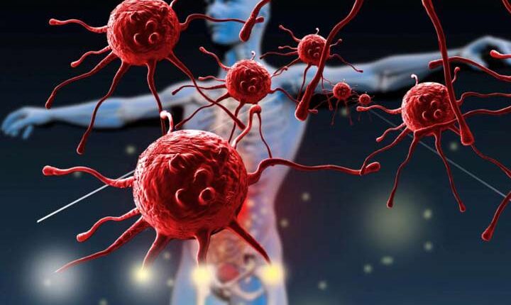 ابتلا به کووید ۱۹ در زمینه بیماریهای التهابی آتوایمیون