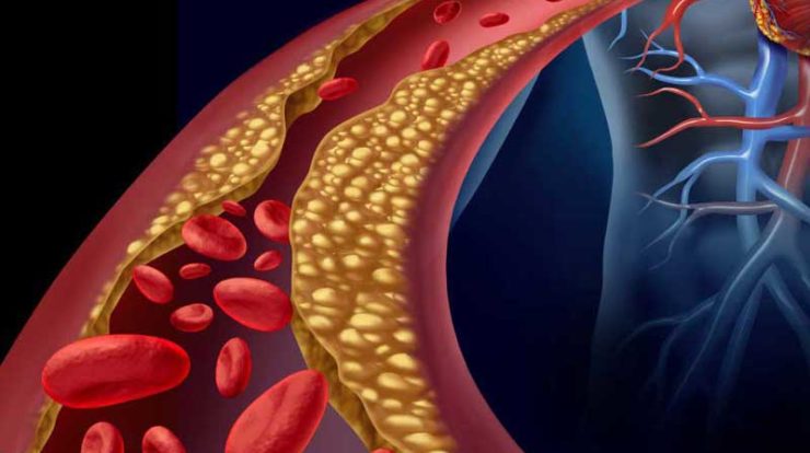 بهترین رقیق کننده خون کدام است؟