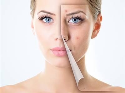 راه‌های مراقبت از پوست در برابر سرطان