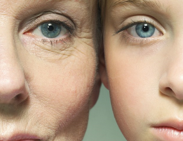 شل شدن پوست بعد از لاغری؛ علت، روش درمان طبیعی و پزشکی