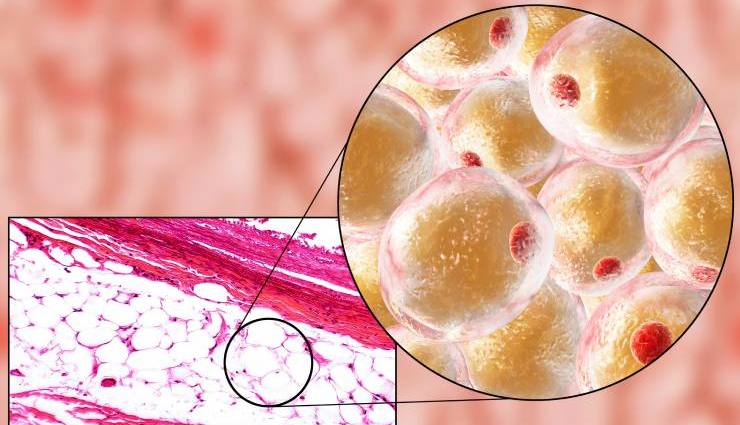 چربی قهوه ای چیست و چه تفاوتی با چربی سفید دارد؟