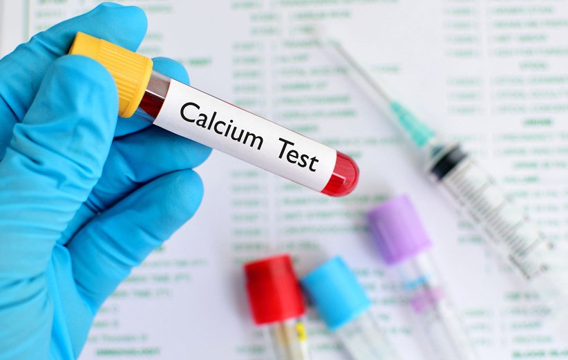 افزایش کلسیم خون نشانهی چیست و چه تأثیری روی سلامتی دارد؟