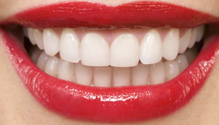 جلوگیری از پوسیدگی دندان با ۶ راهکاری که لبخندی زیبا می‌آفریند