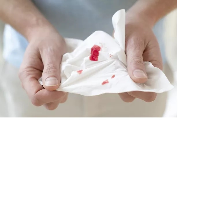 آیا آلرژی می‌تواند باعث خون دماغ شدن شود؟