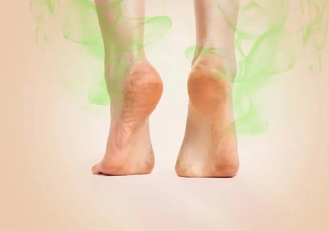 10 عامل بوی بد پاها