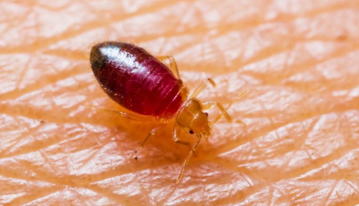 جای نیش ساس؛ روش درمان و پیشگیری