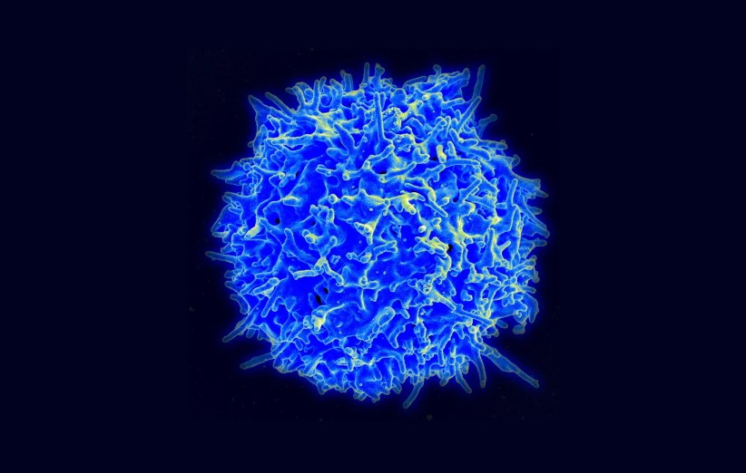 امیدهای تازه برای درمان بیماری لوپوس