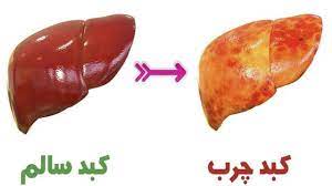 برای مقابله با کبد چرب چه بخوریم؟