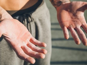 ۸ راهکار برای درمان و پیشگیری از پینه بستن دست‌ها هنگام وزنه زدن