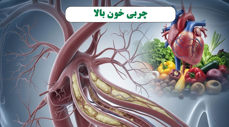 چربی خون بالا: دشمن پنهان رگهای شما!