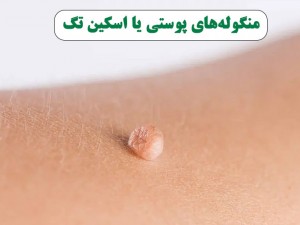 آیا منگوله های گوشتی با ظاهری ناخوشایند حاوی اخباری از درون بدنمان هستند؟!