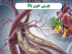 چربی خون بالا: دشمن پنهان رگ‌های شما!