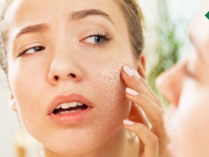 تشخیص ضد آفتاب‌های مناسب پوست خشک با شناخت 4 ماده موثر