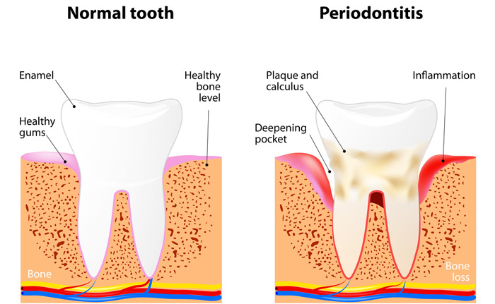 سلامت استخوان‌ها و دندان‌ها