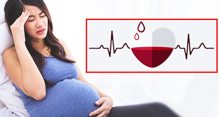 کم خونی و زنان باردار