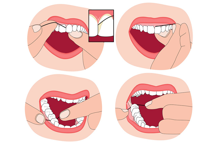 نحوه صحیح نخ دندان کشیدن