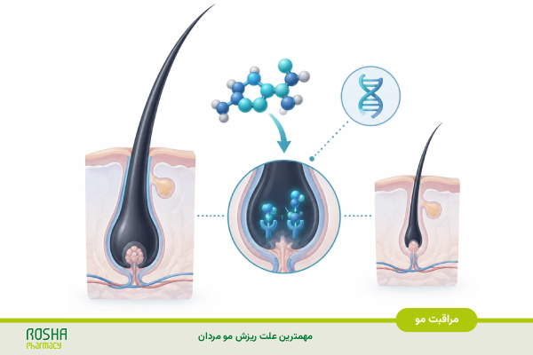 مهمترین علت ریزش مو مردان