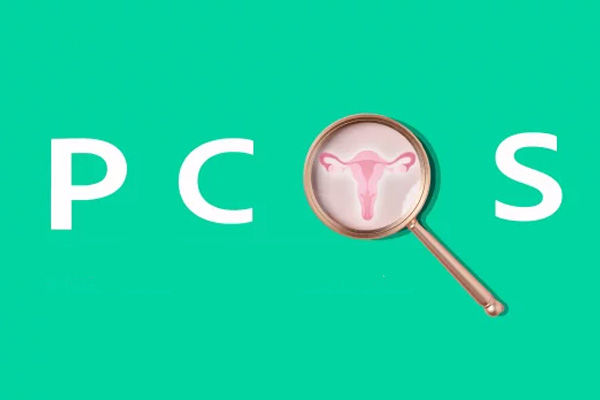 پلی‌کیستیک تخمدان (PCOS) 