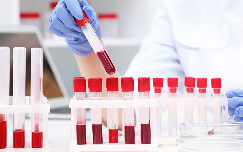 چقدر طول می‌کشد تا نتایج آزمایش خون مشخص شود؟