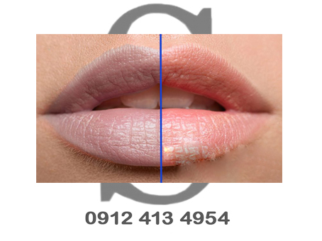 بهترین رنگ برای اصلاح کبودی لب