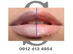 بهترین رنگ برای اصلاح کبودی لب