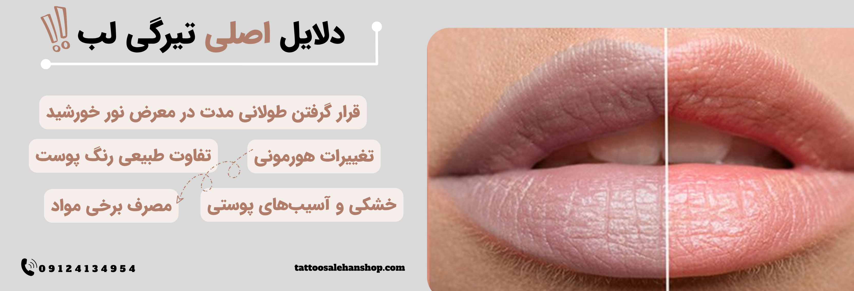 دلایل اصلی تیرگی لب