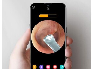 دستگاه آندوسکوپی و پاک کننده داخل گوش شیائومی Xiaomi Bebird R1 Smart Visual Ear Sticks Endoscope