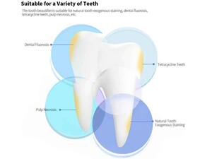سفید کننده دندان شیائومی Xiaomi Dr.Bei W7 Ultrasonic Teeth Whitener White مناسب برای انواع دندان ها