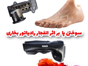سوختگی پا بر اثر انفجار رادیاتور بخاری 206 ، 207 و رانا