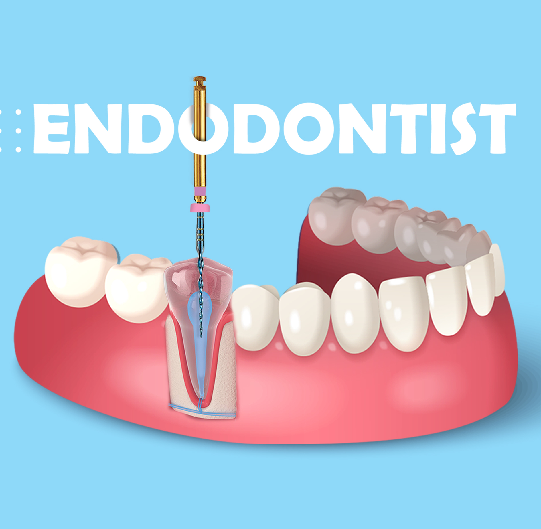 اندودنتیکس