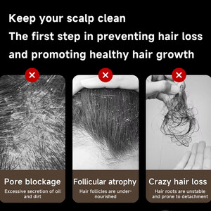 شانه ارتعاشی نور درمانی قرمز شیائومی برای تحریک رشد مو