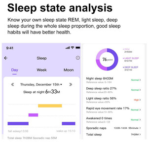 خرید حلقه هوشمند ایکس او