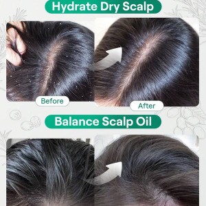 روغن مو و پوست سر رزماری  15 میلی لیتر Rosemary Hair And Scalp Oil -15ml شیگلم SHEGLAM