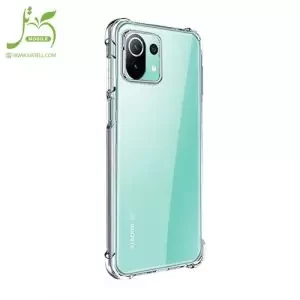 Xiaomi-Mi-11-Lite-Mi-11-Lite-5G-2-300×300