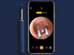 دستگاه آندوسکوپی و پاک کننده داخل گوش شیائومی Xiaomi BeBird Note 3 Pro Smart Visual Ear Cleaning