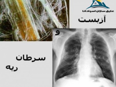 خطرات آزبست – پشم سنگ عایقی عاری از آزبست (Dangers of Asbestos)