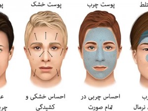 نوع پوستت چیه؟
