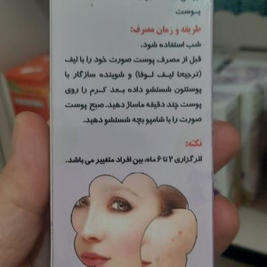 کرم ضدلک نیکا (35 گرم)