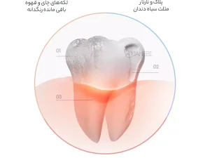 مسواک برقی شیائومی D1-W