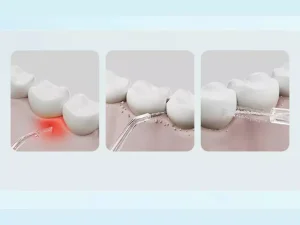 دستگاه شست و شوی دهان و دندان شیائومی Xiaomi Mijia Electric Oral Irrigation F300 MEO703 Dental Irrigator Teeth