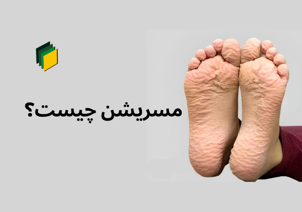 مسریشن زخم چیست؟