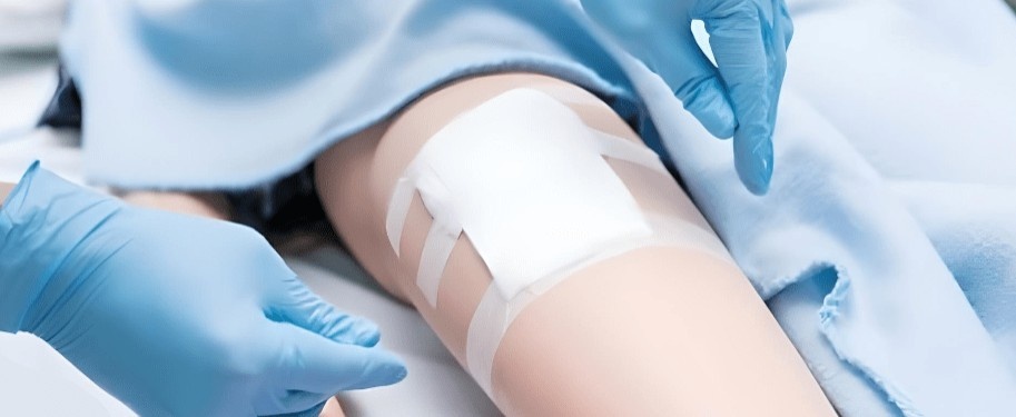 عوامل موثر بر بهبود زخم