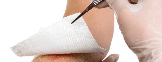 4 مرحله ترمیم زخم