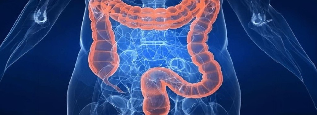 سرطان کولون (درمان)