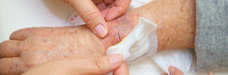 مراقبت پرستاری در زخم(تعیین مرحله زخم، تشخیص و مداخلات)